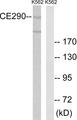 CEP290 Antibody - Western blot analysis of extracts from K562 cells, using CEP290 antibody.