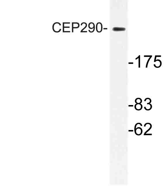 CEP290 Antibody - Western blot of CEP290 (F812) pAb in extracts from K562 cells.