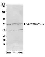 CEP44 / KIAA1712 Antibody - Detection of human CEP44/KIAA1712 by western blot. Samples: Whole cell lysate (50 µg) from HeLa, HEK293T, and Jurkat cells prepared using NETN lysis buffer. Antibody: Affinity purified rabbit anti-CEP44/KIAA1712 antibody used for WB at 1 µg/ml. Detection: Chemiluminescence with an exposure time of 10 seconds.