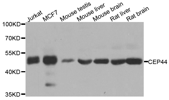 CEP44 / KIAA1712 Antibody - Western blot analysis of extracts of various cell lines.