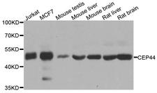 CEP44 / KIAA1712 Antibody - Western blot analysis of extracts of various cell lines.