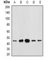 CEP44 / KIAA1712 Antibody - Western blot analysis of CEP44 expression in Jurkat (A); MCF7 (B); mouse testis (C); mouse liver (D); rat brain (E) whole cell lysates.