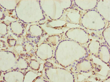 CEP44 / KIAA1712 Antibody - Immunohistochemistry of paraffin-embedded human thyroid tissue at dilution of 1:100