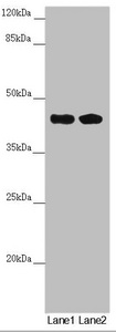 CEP44 / KIAA1712 Antibody - Western blot All Lanes:CEP44 antibody at 6.92 ug/ml Lane 1: Jurkat whole cell lysate Lane 2: MCF7 whole cell lysate Secondary Goat polyclonal to rabbit IgG at 1/10000 dilution Predicted band size: 44 kDa Observed band size: 44 kDa