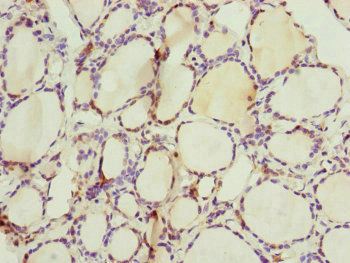 CEP44 / KIAA1712 Antibody - Immunohistochemistry of paraffin-embedded human thyroid tissue at dilution of 1:100