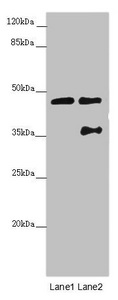 CEP44 / KIAA1712 Antibody - Western blot All Lanes:CEP44 antibody at 3.09 ug/ml Lane 1: Jurkat whole cell lysate Lane 2: MCF7 whole cell lysate Secondary Goat polyclonal to rabbit IgG at 1/10000 dilution Predicted band size: 44 kDa Observed band size: 44,36 kDa
