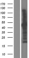 CEP44 / KIAA1712 Protein - Western validation with an anti-DDK antibody * L: Control HEK293 lysate R: Over-expression lysate