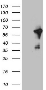 CEP55 Antibody - HEK293T cells were transfected with the pCMV6-ENTRY control. (Left lane) or pCMV6-ENTRY CEP55. (Right lane) cDNA for 48 hrs and lysed. Equivalent amounts of cell lysates. (5 ug per lane) were separated by SDS-PAGE and immunoblotted with anti-CEP55. (1:2000)