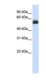 CEP55 Antibody - CEP55 antibody Western blot of Fetal Lung lysate. This image was taken for the unconjugated form of this product. Other forms have not been tested.