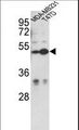 CEP55 Antibody - Western blot of CEP55 Antibody in MDA-MB231, T47D cell line lysates (35 ug/lane). CEP55 (arrow) was detected using the purified antibody.