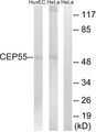 CEP55 Antibody - Western blot analysis of lysates from HeLa and HUVEC cells, using CEP55 Antibody. The lane on the right is blocked with the synthesized peptide.
