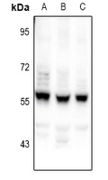 CEP55 Antibody - Western blot analysis of CEP55 expression in HEK293T (A), HCT116 (B), A549 (C) whole cell lysates.