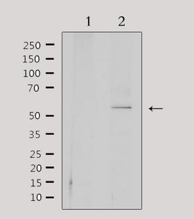 CEP55 Antibody - Western blot analysis of extracts of 293 cells using CEP55 antibody. Lane 1 was treated with the antigen-specific peptide.