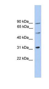 CEP57L1 Antibody - CEP57L1 / C6orf182 antibody Western blot of Jurkat lysate. This image was taken for the unconjugated form of this product. Other forms have not been tested.