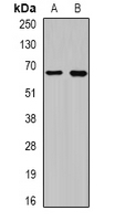 CEP57L1 Antibody - Western blot analysis of CEP57L1 expression in BT474 (A); 22RV1 (B) whole cell lysates.