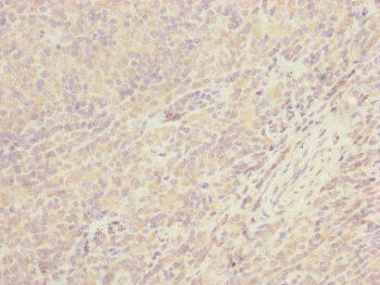 CEP57L1 Antibody - Immunohistochemistry of paraffin-embedded human tonsil tissue at dilution of 1:100