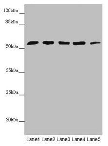 CEP57L1 Antibody - Western blot All Lanes:CEP57L1 antibody at 6.26 ug/ml Lane 1: CEM whole cell lysate Lane 2: 293T whole cell lysate Lane 3: Hela whole cell lysate Lane 4: Jurkat whole cell lysate Lane 5: A549 whole cell lysate Secondary Goat polyclonal to rabbit IgG at 1/10000 dilution Predicted band size: 54,46 kDa Observed band size: 54 kDa