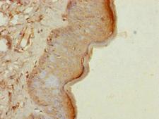 CEP57L1 Antibody - Immunohistochemistry of paraffin-embedded human skin tissue at dilution of 1:100
