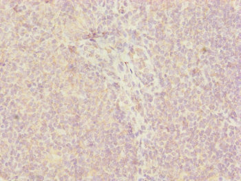 CEP57L1 Antibody - Immunohistochemistry of paraffin-embedded human tonsil tissue at dilution of 1:100