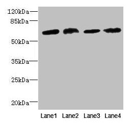 CEP63 Antibody - Western blot All lanes: CEP63 antibody at 12µg/ml Lane 1: K562 whole cell lysate Lane 2: Hela whole cell lysate Lane 3: NIH/3T3 whole cell lysate Lane 4: Raji whole cell lysate Secondary Goat polyclonal to rabbit IgG at 1/10000 dilution Predicted band size: 82, 64, 58, 56 kDa Observed band size: 64, 75 kDa