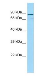 CEP63 Antibody - CEP63 antibody Western Blot of Fetal Kidney.  This image was taken for the unconjugated form of this product. Other forms have not been tested.