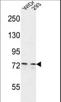 CEP63 Antibody - CEP63 Antibody western blot of WiDr,293 cell line lysates (35 ug/lane). The CEP63 antibody detected the CEP63 protein (arrow).