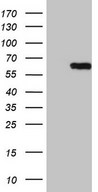 CEP63 Antibody - HEK293T cells were transfected with the pCMV6-ENTRY control. (Left lane) or pCMV6-ENTRY CEP63. (Right lane) cDNA for 48 hrs and lysed. Equivalent amounts of cell lysates. (5 ug per lane) were separated by SDS-PAGE and immunoblotted with anti-CEP63. (1:2000)