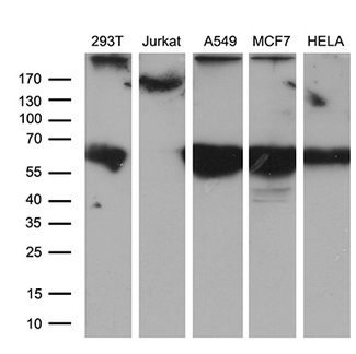 CEP63 Antibody - Western blot analysis of extracts. (35ug) from 5 different cell lines by using anti-CEP63 monoclonal antibody. (1:500)