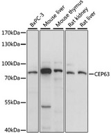 CEP63 Antibody - Western blot analysis of extracts of various cell lines, using CEP63 antibody at 1:1000 dilution. The secondary antibody used was an HRP Goat Anti-Rabbit IgG (H+L) at 1:10000 dilution. Lysates were loaded 25ug per lane and 3% nonfat dry milk in TBST was used for blocking. An ECL Kit was used for detection and the exposure time was 1s.