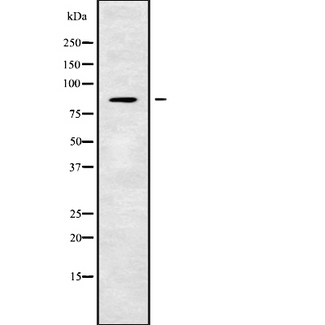 CEP63 Antibody - Western blot analysis of CEP63 using Jurkat whole cells lysates