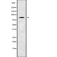 CEP63 Antibody - Western blot analysis of CEP63 using Jurkat whole cells lysates