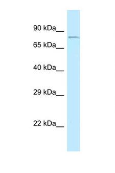 CEP68 Antibody - CEP68 antibody Western blot of Fetal Liver lysate. Antibody concentration 1 ug/ml.  This image was taken for the unconjugated form of this product. Other forms have not been tested.