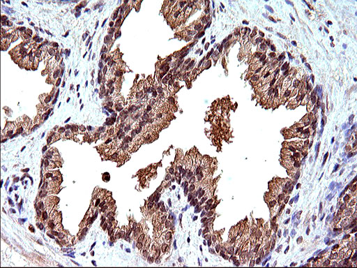CEP68 Antibody - IHC of paraffin-embedded Human prostate tissue using anti-CEP68 mouse monoclonal antibody. (Heat-induced epitope retrieval by 10mM citric buffer, pH6.0, 120°C for 3min).