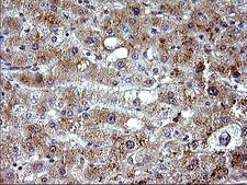 CEP68 Antibody - IHC of paraffin-embedded Human liver tissue using anti-CEP68 mouse monoclonal antibody. (Heat-induced epitope retrieval by 10mM citric buffer, pH6.0, 120°C for 3min).