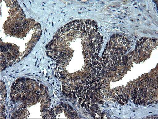 CEP68 Antibody - IHC of paraffin-embedded Human prostate tissue using anti-CEP68 mouse monoclonal antibody. (Heat-induced epitope retrieval by 1 mM EDTA in 10mM Tris, pH8.5, 120°C for 3min).