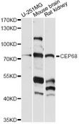 CEP68 Antibody - Western blot analysis of extracts of various cell lines, using CEP68 antibody at 1:1000 dilution. The secondary antibody used was an HRP Goat Anti-Rabbit IgG (H+L) at 1:10000 dilution. Lysates were loaded 25ug per lane and 3% nonfat dry milk in TBST was used for blocking. An ECL Kit was used for detection and the exposure time was 90s.