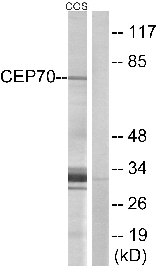 CEP70 Antibody - Western blot analysis of lysates from COS cells, using CEP70 Antibody. The lane on the right is blocked with the synthesized peptide.