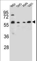 CEP70 Antibody - CEP70 Antibody western blot of WiDr,CHO,A549,U251 cell line lysates (35 ug/lane). The CEP70 antibody detected the CEP70 protein (arrow).
