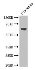 CEP70 Antibody - Western Blot Positive WB detected in: Human placenta tissue All lanes: CEP70 antibody at 3.4µg/ml Secondary Goat polyclonal to rabbit IgG at 1/50000 dilution Predicted band size: 70, 65, 26, 68 kDa Observed band size: 70 kDa