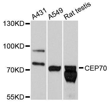CEP70 Antibody - Western blot analysis of extracts of various cell lines, using CEP70 antibody at 1:3000 dilution. The secondary antibody used was an HRP Goat Anti-Rabbit IgG (H+L) at 1:10000 dilution. Lysates were loaded 25ug per lane and 3% nonfat dry milk in TBST was used for blocking. An ECL Kit was used for detection and the exposure time was 1s.