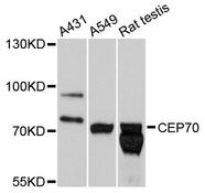 CEP70 Antibody - Western blot analysis of extracts of various cell lines, using CEP70 antibody at 1:3000 dilution. The secondary antibody used was an HRP Goat Anti-Rabbit IgG (H+L) at 1:10000 dilution. Lysates were loaded 25ug per lane and 3% nonfat dry milk in TBST was used for blocking. An ECL Kit was used for detection and the exposure time was 1s.