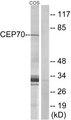 CEP70 Antibody - Western blot analysis of extracts from COS cells, using CEP70 antibody.
