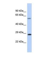 CEP70 Antibody - Western blot of Human Placenta . CEP70 antibody dilution 1.0 ug/ml.  This image was taken for the unconjugated form of this product. Other forms have not been tested.