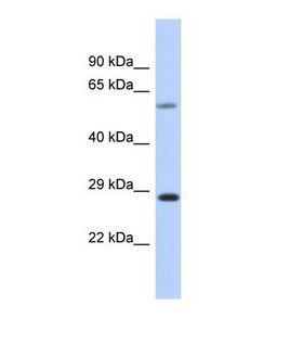 CEP70 Antibody - Western blot of Human Placenta . CEP70 antibody dilution 1.0 ug/ml.  This image was taken for the unconjugated form of this product. Other forms have not been tested.