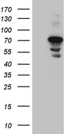 CEP72 Antibody - HEK293T cells were transfected with the pCMV6-ENTRY control. (Left lane) or pCMV6-ENTRY CEP72. (Right lane) cDNA for 48 hrs and lysed. Equivalent amounts of cell lysates. (5 ug per lane) were separated by SDS-PAGE and immunoblotted with anti-CEP72. (1:2000)