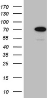CEP72 Antibody - HEK293T cells were transfected with the pCMV6-ENTRY control. (Left lane) or pCMV6-ENTRY CEP72. (Right lane) cDNA for 48 hrs and lysed. Equivalent amounts of cell lysates. (5 ug per lane) were separated by SDS-PAGE and immunoblotted with anti-CEP72. (1:2000)