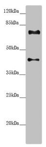 CEP72 Antibody - Western blot All Lanes:CEP72 antibody at 3.37 ug/ml+ Hela whole cell lysate Secondary Goat polyclonal to rabbit IgG at 1/10000 dilution Predicted band size: 72,22 kDa Observed band size: 72,42 kDa