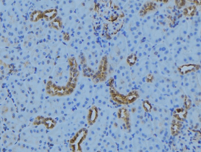CEP72 Antibody - 1:100 staining mouse kidney tissue by IHC-P. The sample was formaldehyde fixed and a heat mediated antigen retrieval step in citrate buffer was performed. The sample was then blocked and incubated with the antibody for 1.5 hours at 22°C. An HRP conjugated goat anti-rabbit antibody was used as the secondary.