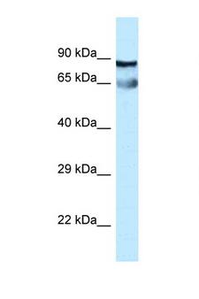 CEP76 Antibody - CEP76 antibody Western blot of Fetal Lung lysate. Antibody concentration 1 ug/ml.  This image was taken for the unconjugated form of this product. Other forms have not been tested.