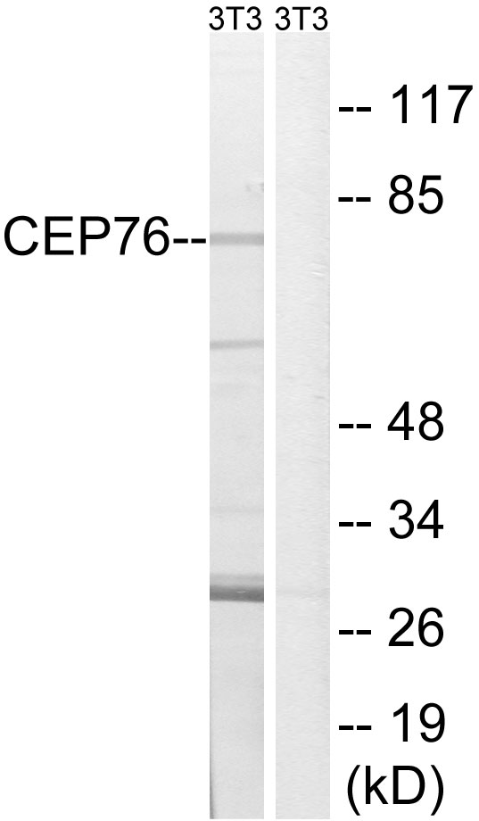 CEP76 Antibody - Western blot analysis of lysates from NIH/3T3 cells, using CEP76 Antibody. The lane on the right is blocked with the synthesized peptide.